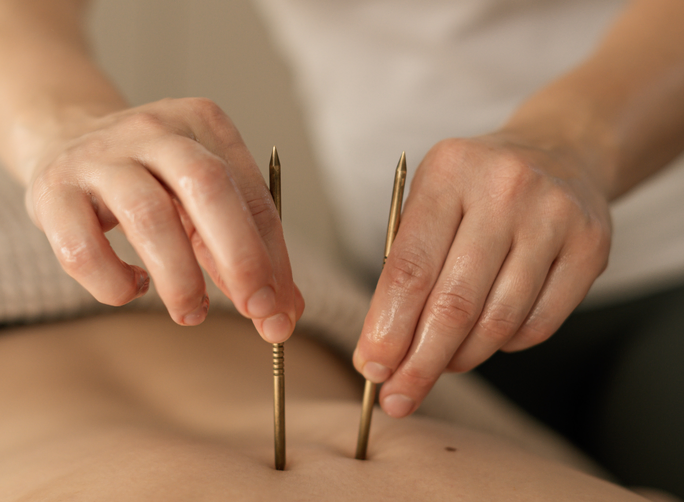 Terapia pinami (pinopresura) — Precyzja, której nie zastąpią żadne dłonie